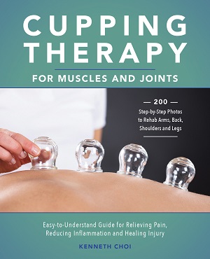 Cupping Therapy for Muscles and Joints Cover Photo
